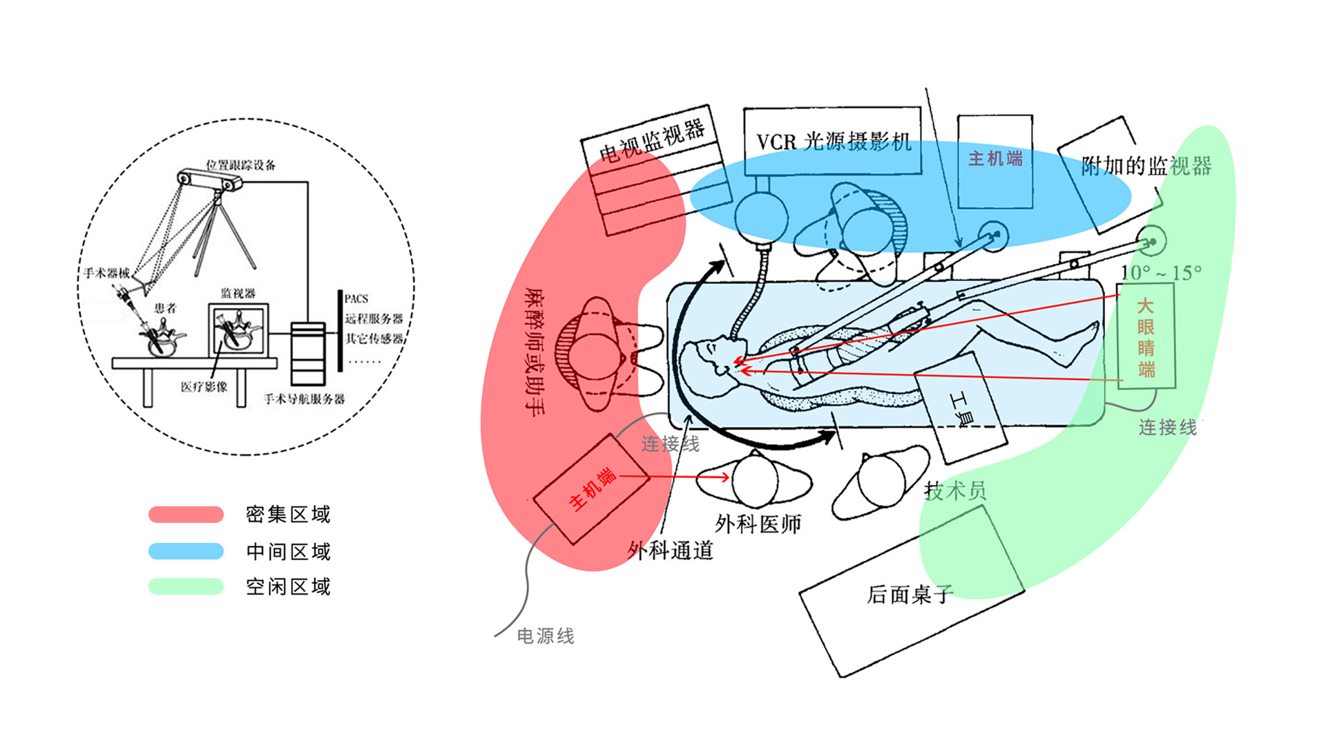 手术导航仪外观设计-安科手术导航仪外观设计